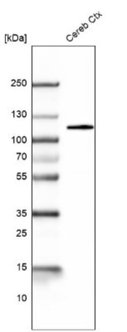 BCL11B Antibody (CL6426), Novus Biologicals:Antibodies:Primary Antibodies
